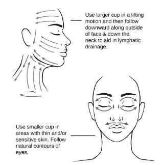 Yüz Hacamatı Abrizon Tekniği