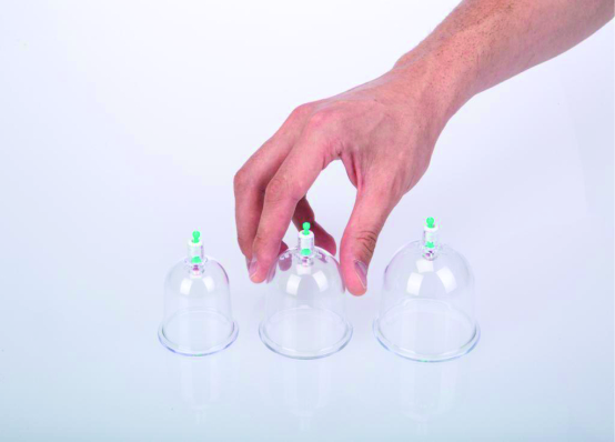 Hacamatın Faydaları: Geleneksel Tedavi Yönteminin Sağlık Üzerindeki Etkileri